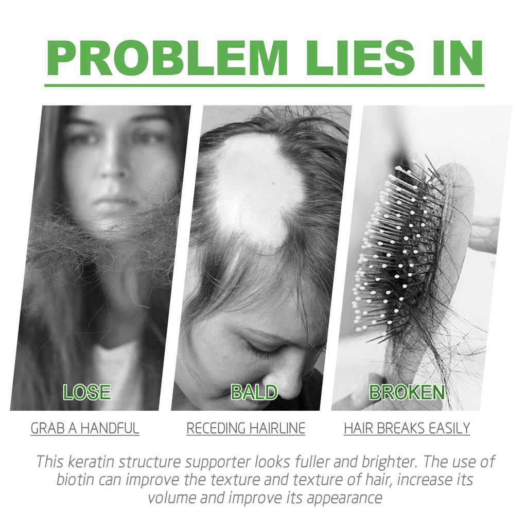 King Of Ginger, Hair Root Nourishing And Thickening Hair Strong Anti-Scalp Massage Treatment Capsule